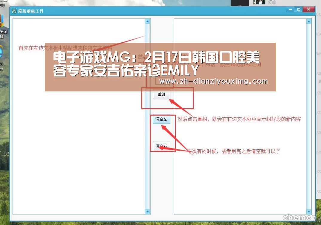 电子游戏MG